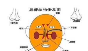 鼻塞怎么办怎样让鼻通气 一分钟治鼻子不通气