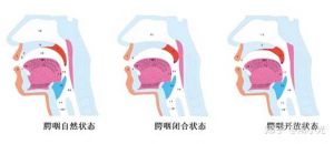 鼻音重纠正方法 部队什么时候解除禁假