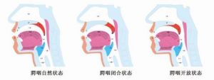 怎么控制鼻音咬字清楚 如何分清前后鼻音