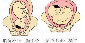 通俗唱法靠前还是靠后 唱歌咬字靠前还是靠后