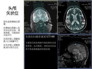 头颅共鸣唱法 后脑有共鸣声