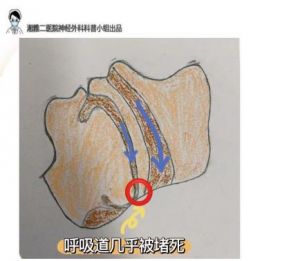 改掉喉咙唱歌习惯：呼吸控制喉部姿势高音技巧与训练