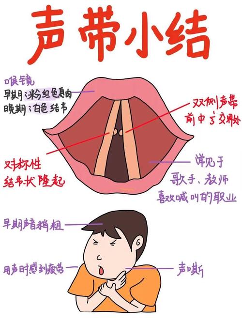 掌握正确发声技巧，告别挤嗓保护声带