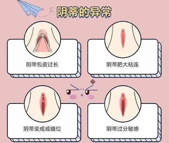 女性私密部位紧致度标准及重要性