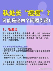 下面长痘痘？5种可能原因及处理方法