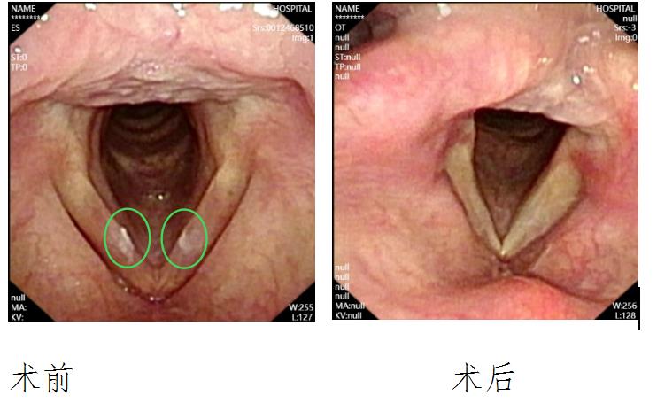 声带保养指南：恢复声音健康的5大秘诀