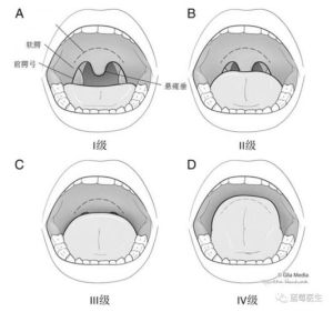 高音技巧揭秘：硬腭vs软腭使用指南