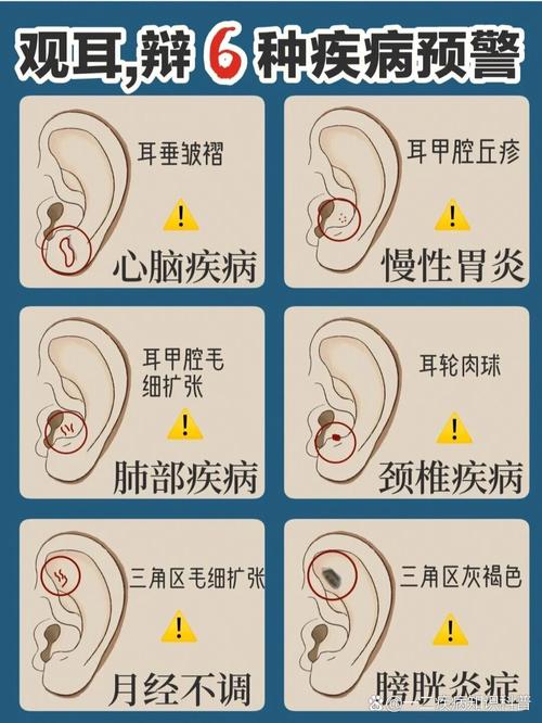 警惕耳朵屏气：四种潜在疾病信号