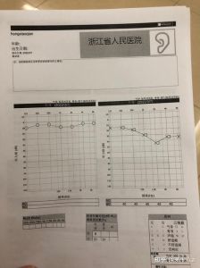 声带麻痹恢复一年：心路历程与康复指南