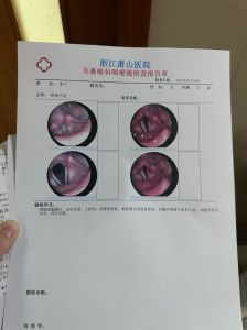 声带结节症状及预防治疗全解析