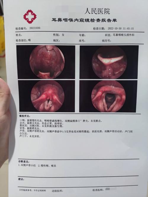 声带小结诱因揭秘：预防指南一览